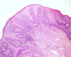 Hematoxilina-eosina × 4.