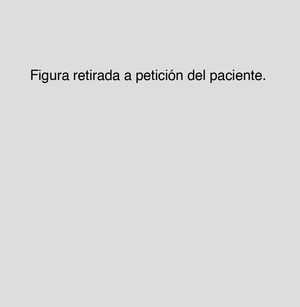 Figura 6