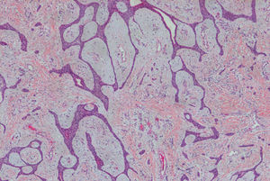 Hematoxilina-eosina ×40.
