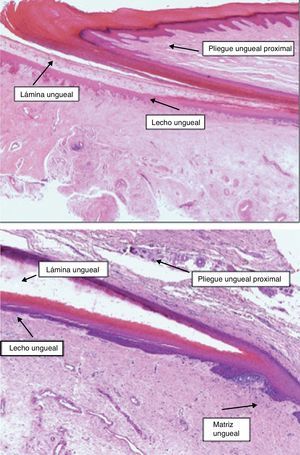 Imagen de hematoxilina-eosina ×20 del aparato ungueal que muestra el aspecto histológico de los distintos elementos que conforman la unidad ungueal.