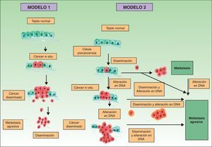 Patogénesis de las metástasis cutáneas. Esquema comparativo del modelo clásico de producción de metástasis y una de las hipótesis más recientemente descritas. Fuente: Sánchez-García I30.