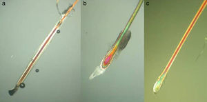Observación del extremo proximal. A. Pelo en anagén. B. Catagén C. Telogén. Características en la tabla 2. Microscopio optico de luz polarizada (x40).