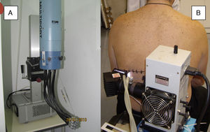 Simuladores solares. A-Simulador solar multipuerto. Emisión de una dosis creciente de radiación solar simulada recogida por una fibra óptica en cada uno de los seis puertos para producir eritema de forma paralela (cada puerto de salida emite una intensidad diferente controlada). B-Simulador solar. El sistema de filtros y foco recoge toda la radiación emitida por la lámpara en un punto (1 cm de diámetro) y las dosis crecientes se obtienen aumentando el tiempo de exposición en cada uno de los puntos.