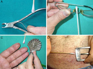 A-D. Diferentes objetos metálicos causantes de dermatitis alérgica de contacto por níquel, con test DMGO positivo.