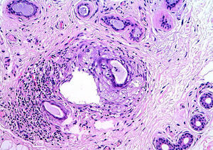 Hematoxilina-eosina ×20