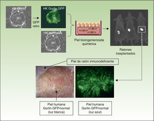 Regeneración de una piel quimérica en ratones inmunodeficientes. Queratinocitos humanos normales y de un paciente con síndrome de Gorlin (marcados con GFP mediante infección con un retrovirus) fueron ensamblados en equivalentes cutáneos bioingenierizados y trasplantados a ratones inmunodeficientes. La piel regenerada (paneles inferiores) muestra la presencia de zonas fluorescentes debidas a los queratinocitos Gorlin y no fluorescentes debidas a la regeneración de piel a expensas de los queratinocitos normales.