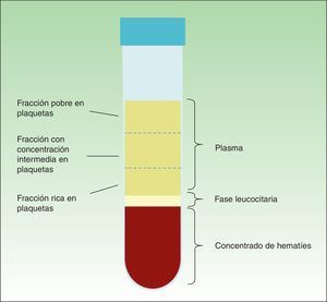 Diferentes fracciones obtenidas tras la centrifugación de la sangre anticoagulada.