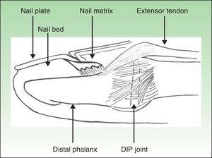 Anatomical relationship between the nail and distal interphalangeal extensor tendor enthesis.