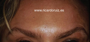 Típicas cejas en «Mefisto» o de diablo.