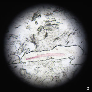 Test de celo bajo visión directa en microscopio óptico donde se observan estructuras fibrilares rosadas (x40).