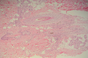 Hematoxilina-eosina ×100.