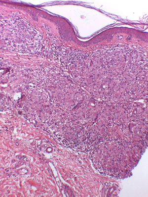 Hematoxilina-eosina ×10.
