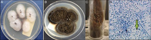 Cultivo de Sporothrix schenckii. A y B) En agar Sabouraud y patata dextrosa a 25¿C, tras 10 días de incubación. C) Fase levaduriforme en agar Seneca, tras 15 días de incubación. D) Imagen microscópica de la fase micelial, microconidias en forma de flor de margarita.