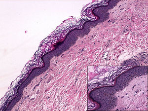 Hematoxilina-eosina ×10. Detalle inferior derecha, ×20.