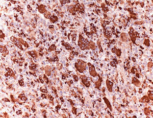InmunohistoquimicaX20.
