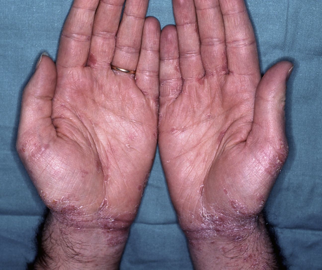 fig0020