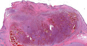 Hematoxilina-eosina.