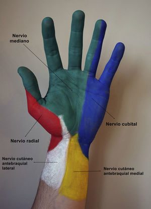Inervación cutánea de la cara anterior de la mano. Amarillo: nervio cutáneo antebraquial medial; azul: nervio cubital; blanco: nervio cutáneo antebraquial lateral; rojo: nervio radial; verde: nervio mediano.