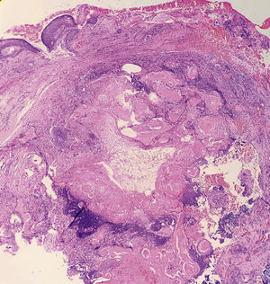Hematoxilina-eosina×40.