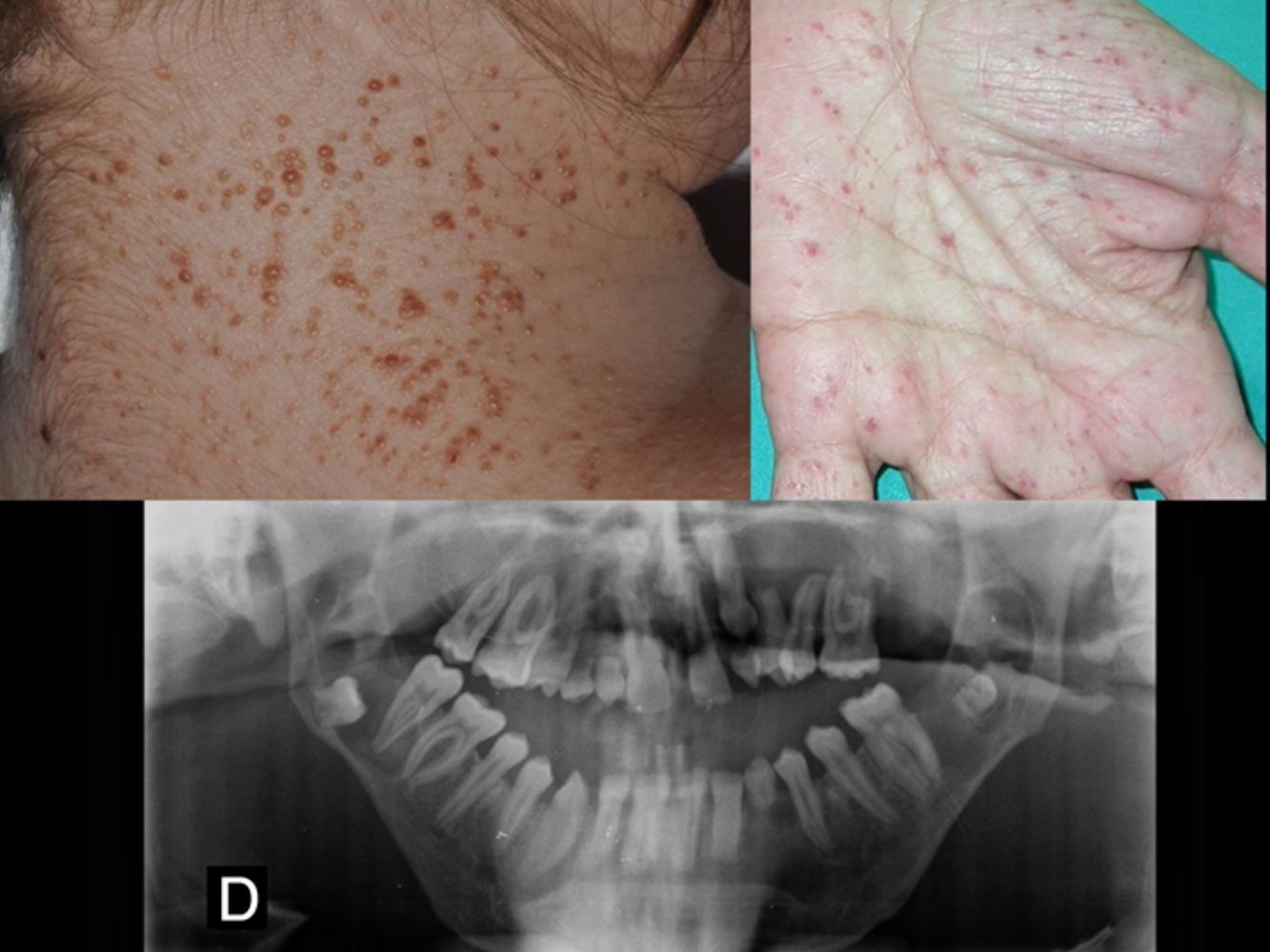fig0025