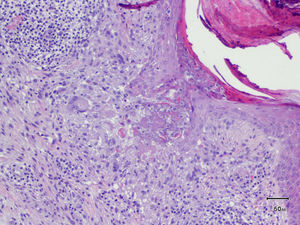 Hematoxilina-eosina×100.