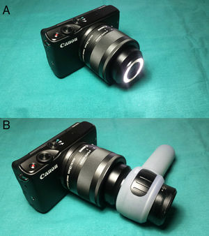 Objetivo Canon EF-M 28mm f/3,5 Macro IS STM. A)Obsérvese su sistema LED en la parte frontal del objetivo. B)El objetivo posibilita un fácil acoplamiento con el dermatoscopio.