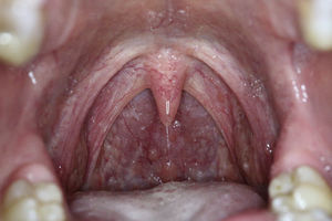 Fotografía de la cavidad oral con una correcta iluminación, lo que permite fotos de mejor calidad y con un enfoque más rápido.
