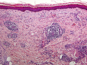 Hematoxilina-eosina ×100.