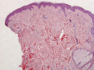 Hematoxilina-eosina, ×40.