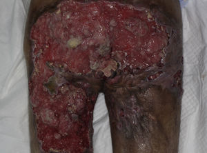 Figura 1