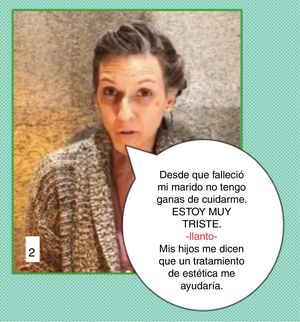 Caso clínico 2 de comunicación en estética. En esta paciente, con muy poco podemos ayudar mucho. Por ejemplo haciendo una catarsis, simplemente ofreciéndole un pañuelo cuando la paciente rompe a llorar. Esto ofrece apoyo, empatía y muestra respeto. La paciente se siente capaz de expresar su emoción en toda su intensidad y en esa catarsis seguramente se da cuenta de que no tiene sentido un tratamiento estético en ese momento. Pero se le puede ofrecer la valoración clínica y la pauta de un tratamiento cosmecéutico domiciliario, para posteriormente, cuando se encuentre mejor, tanto su piel con el tratamiento, como a nivel anímico, ofrecerle tratamientos que mejoren su fotoenvejecimiento a nivel global. Esto hará una función de conexión afectiva, donde la empatía se dirige a que el paciente no deje de confiar en nosotros como personas y continúe percibiéndonos como agentes de salud que procuran su bien. A veces retrasar un tratamiento es lo más indicado para empezar más adelante con más seguridad en los resultados y en la adquisición de una rutina, a la vez que nos reafirma como médicos que somos. La paciente seguramente se va de la consulta más animada: por que se siente escuchada, acompañada, atendida y con una ilusión y motivación para volver a nuestra consulta en un futuro.
