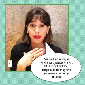 Caso clínico 4 de comunicación en estética. En la cuarta paciente el médico se puede sorprender, por múltiples motivos. La paciente identifica un defecto que nosotros no vemos (podríamos estar ante un trastorno dismorfofóbico corporal). Además podría estar mintiéndonos al decir que puso hialurónico hace mucho tiempo (al ver sus labios vemos que o lo puso hace poco o no lleva hialurónico, sino otro material que contraindica el tratamiento) y además, se queja de resultados previos. Por tanto, evitando herir sus sentimientos diremos que en su caso nosotros no podemos ofrecerle ese tipo de tratamiento porque médicamente no lo consideramos actualmente indicado; no precisa llevarle la contraria ni tampoco darle la razón.