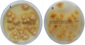 Cultivo de las escamas en placas de agar Sabouraud cloranfenicol actidiona de 15 días (28°C). Se observan colonias de superficie plana y borde ligeramente estrellado, de color amarillo-limón brillante en el anverso A) y el reverso B). En el centro de las colonias se desarrolló un micelio superficial blanco-harinoso con ligeros pliegues radiales.