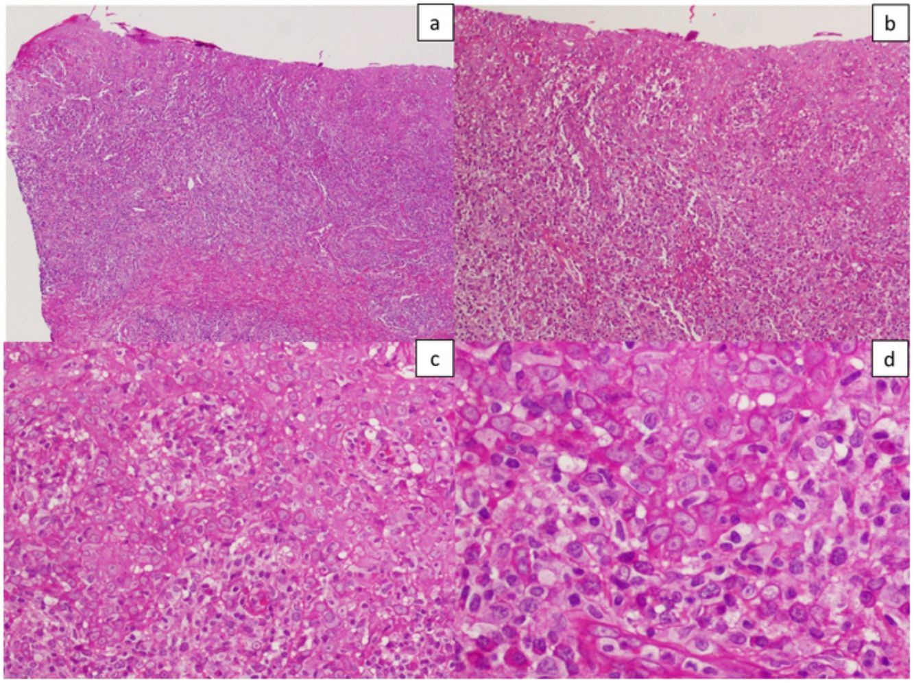 fig0035