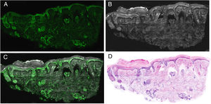 Imagen de piel normal en diferentes modos: A) fluorescencia; B) reflectancia; C) fusión; D) hematoxilina y eosina digital.