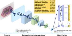 Modelo de funcionamiento de una red neuronal convolucional. La imagen de entrada se transforma a través de las sucesivas capas (convolucionales y de pooling). Las capas finales (totalmente conectadas) clasifican los datos en un determinado diagnóstico11.