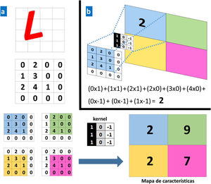a. Ejemplo de una operación convolucional. Un ordenador ve una imagen (L) como una matriz de números de 4×4. Cada valor de la imagen de entrada se multiplica por un filtro o kernel. Como resultado se obtiene una nueva representación reducida (mapa de características de 2×2). b. Ejemplo de una operación concreta para los valores en el recuadro azul.