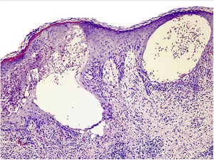 Hematoxilina-eosina, ×20.