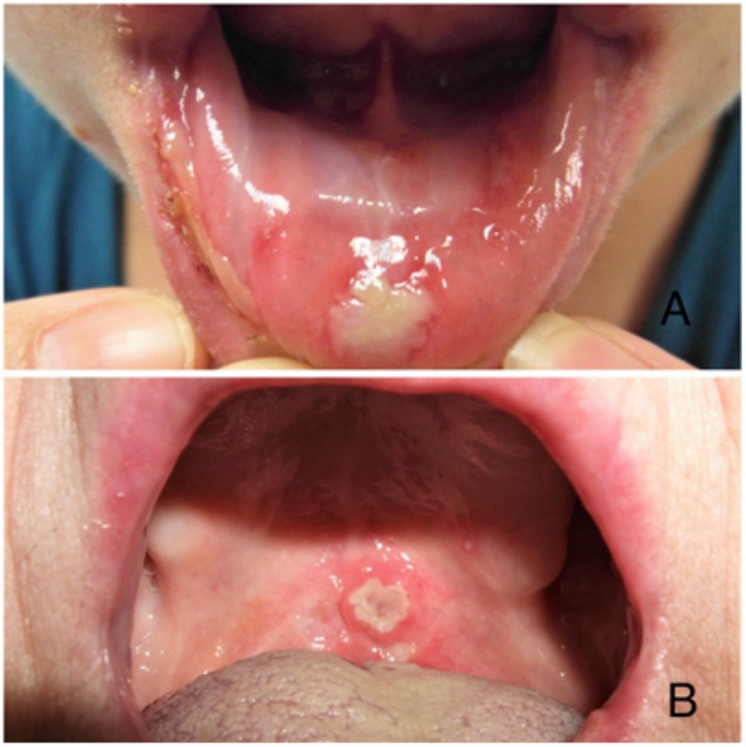 fig0030