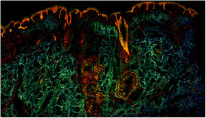 Fragmento de piel sana observada con microscopía confocal de fluorescencia a color.