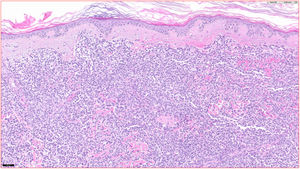 Hematoxilina eosina ×20.