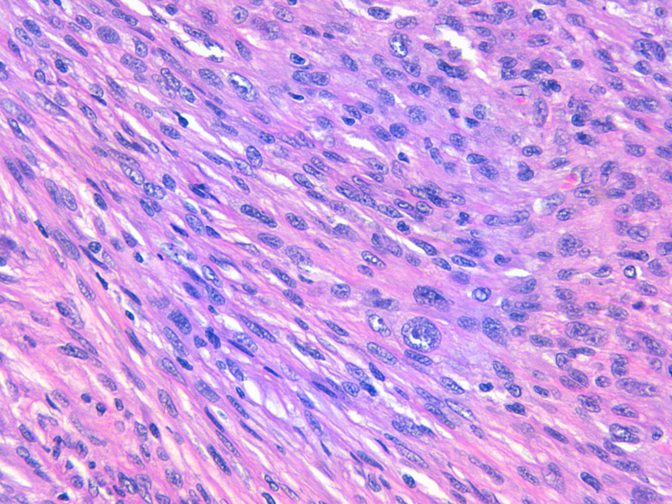 fig0030