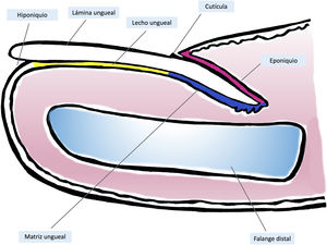 Anatomía macroscópica de la uña normal: el aparato ungueal está cubierto en su parte más proximal por el pliegue ungueal proximal. El epitelio de la cara ventral de este pliegue se denomina eponiquio (en rosa), y produce la cutícula verdadera (en negro), que se adhiere firmemente a la lámina. La matriz ungueal (en azul) se divide en matriz proximal y distal, es la productora de la lámina y se continúa distalmente con el lecho. Tanto la matriz como el lecho están cubiertos por la lámina ungueal. Finalmente, el lecho (en amarillo) termina distalmente en el hiponiquio.