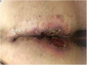 Aspecto de las UP correspondientes al caso 10.