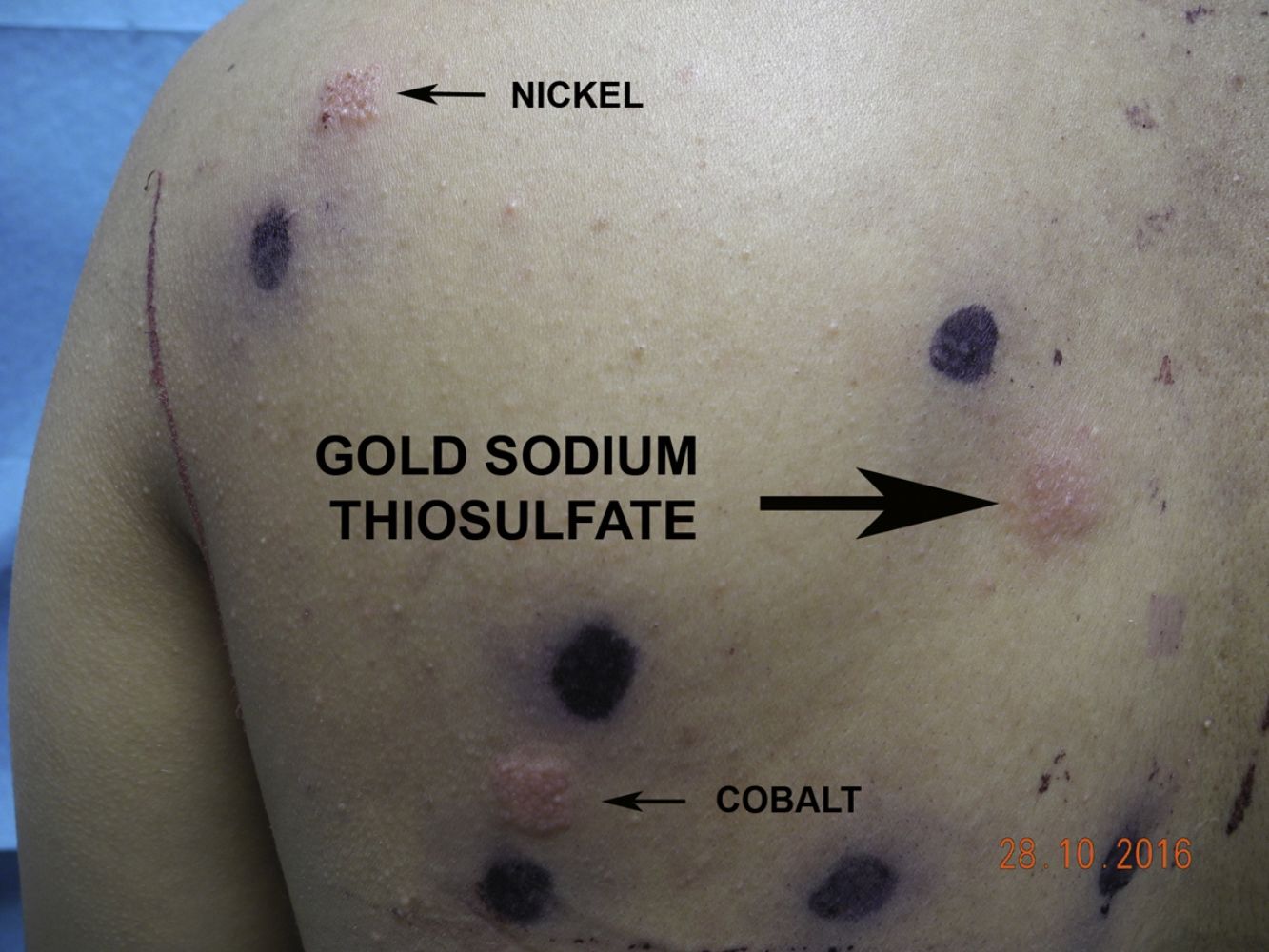 fig0025