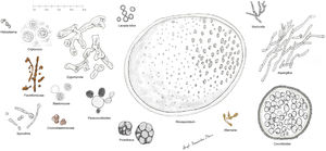 Representación esquemática de las principales formas de hongos causantes de las micosis cutáneas profundas en humanos. Se ha incluido a Prototeca por comparación, a pesar de ser un alga.