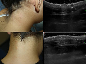 Características clínicas y ecográficas.