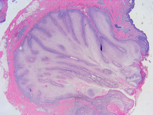 Hematoxilina Eosina x40.