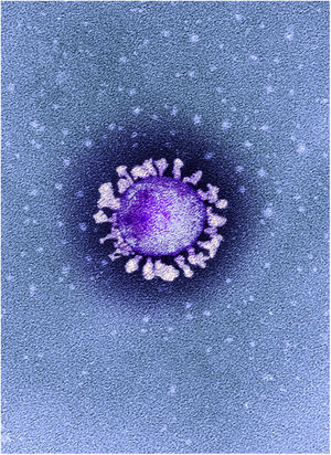 Microfotografía electrónica de transmisión (MET) coloreada de una partícula de coronavirus SARS-CoV-2 aislada de un caso de la enfermedad COVID-19 en el Reino Unido. ©National Infection Service, United Kingdom / Science Photo Library / agefotostock. Se observan con claridad las espículas o protuberancias características en su superficie, proyectadas hacia el exterior, con un contorno llamativamente irregular y con una morfología bastante heterogénea.