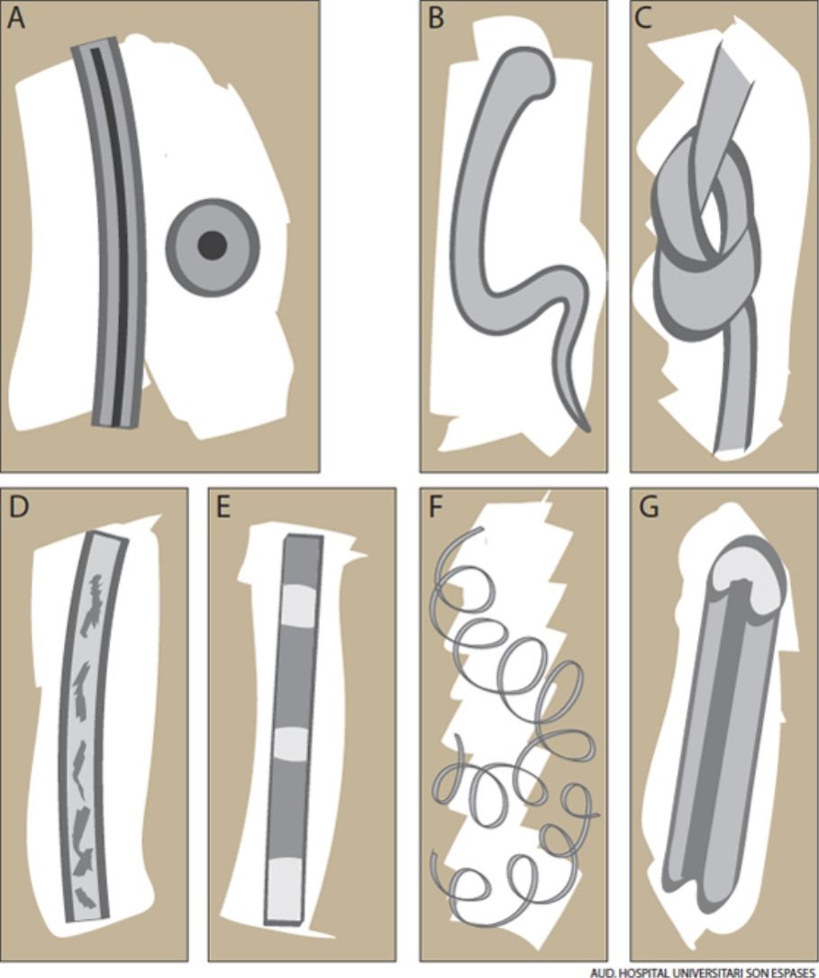 fig0045